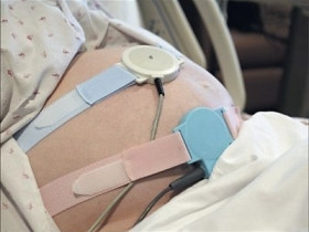 Fetal Monitoring Belt 3 40 600 400 100