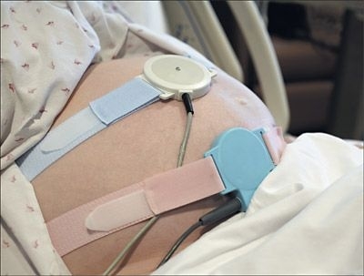 2Pcs/Pack Monitoring Belt Fetal Heart Monitoring Belt Fetal Monitoring Bandage Monitoring Bandage Belt Heart Monitor Tool